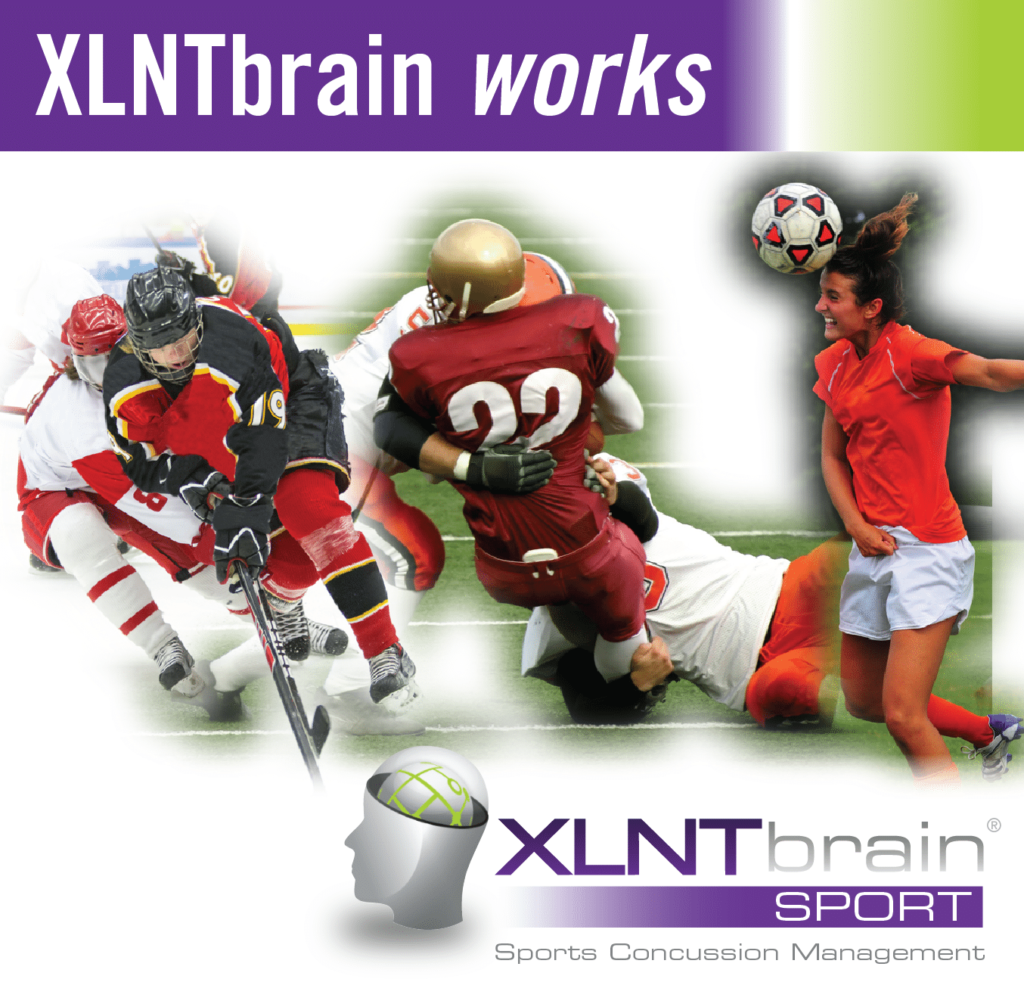 XLNTBrain works.