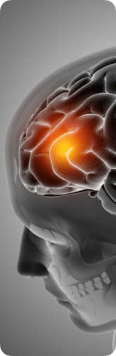 concussion in brain
